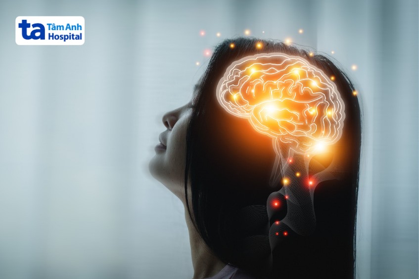 chụp MRI não