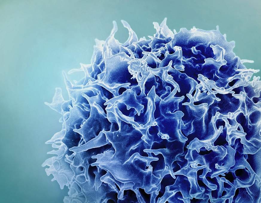 Tế bào lympho T (T cell) màu xanh lam dưới kính hiển vi điện tử quét đã được tô màu.