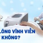 khi nào nên lựa chọn triệt lông vĩnh viễn