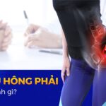 Đau hông phải