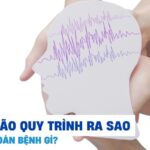 Điện não đồ thường quy để đánh giá hoạt động não khi tỉnh táo