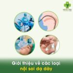 Hình ảnh minh họa nội soi dạ dày