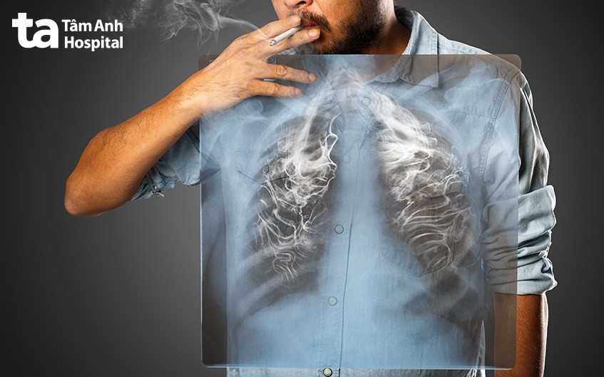 Chăm sóc phổi đúng cách giúp duy trì sức khỏe tốt