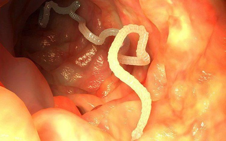 Sán lá sinh sản dưới hình thức đa phôi