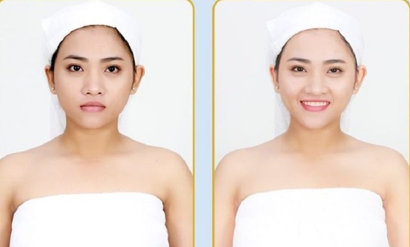 Giá tắm trắng phụ thuộc vào nhiều yếu tố