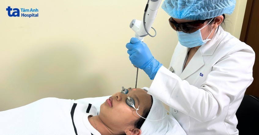 Quy trình xóa xăm chân mày tại Bệnh viện Đa khoa Tâm Anh, đảm bảo an toàn và hiệu quả cho khách hàng.