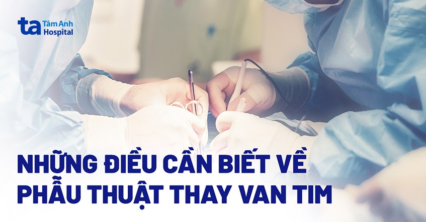 Phẫu thuật thay van tim