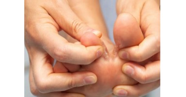 Cách phòng ngừa bệnh nấm