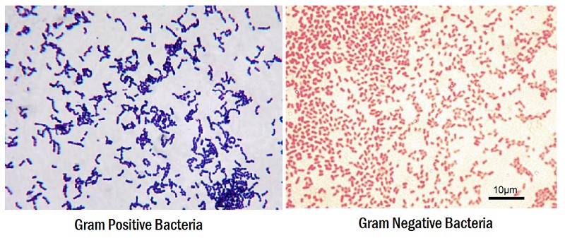 Tính chất bắt màu của vi khuẩn gram dương và gram âm