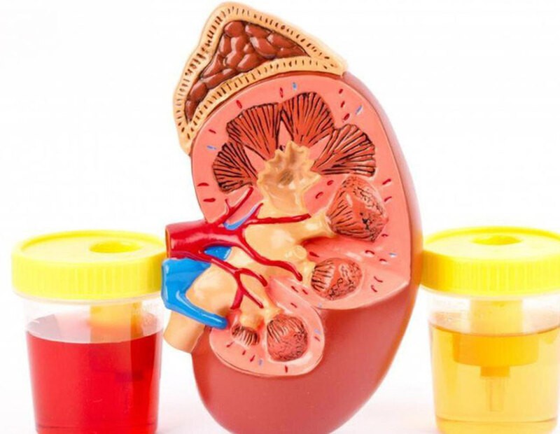 Niá»‡u quáº£n lÃ  á»‘ng dáº«n nÆ°á»›c tiá»ƒu tá»« bá»ƒ tháº­n xuá»‘ng bÃ ng quang