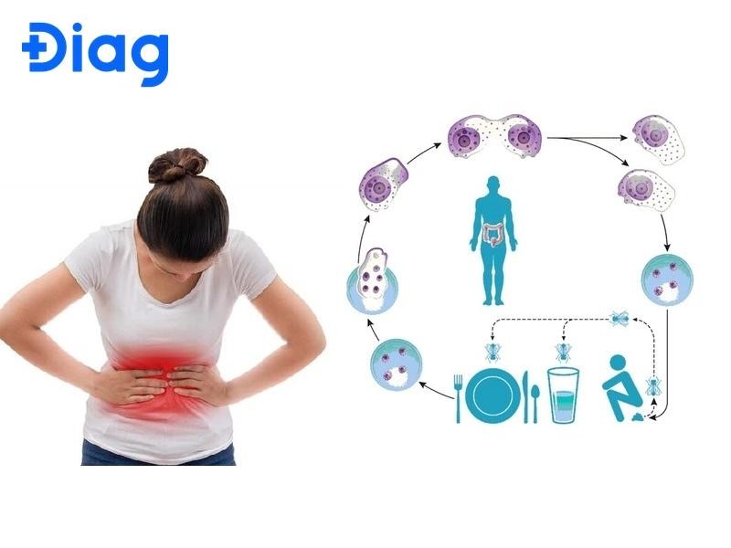Hình ảnh minh họa con đường lây truyền trùng kiết lỵ qua ăn uống