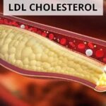 Axit Linoleic Giúp Giảm Cholesterol LDL Trong Máu