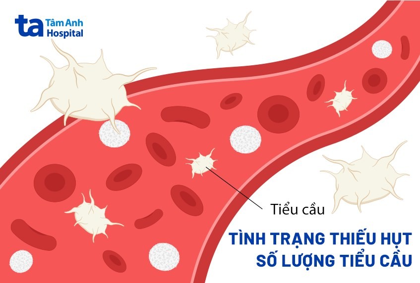 Tiểu cầu đóng vai trò quan trọng trong quá trình đông máu, giúp ngăn chặn mất máu khi có vết thương