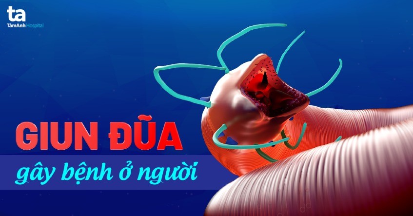 Giun đũa trưởng thành ký sinh trong ruột người