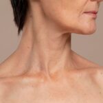 Hình ảnh mụn thịt thừa ở cổ