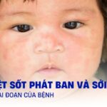 Bàn tay lái xe tải
