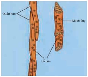 Tế bào quản bào trong cấu tạo tế bào mạch gỗ của cây