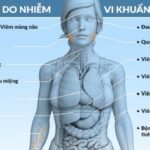 Vi khuẩn gây bệnh