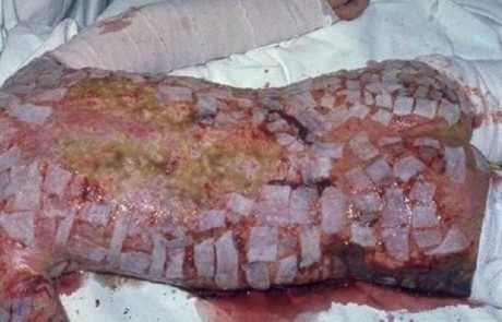 Hình ảnh minh họa các tác động của phóng xạ lên cơ thể người