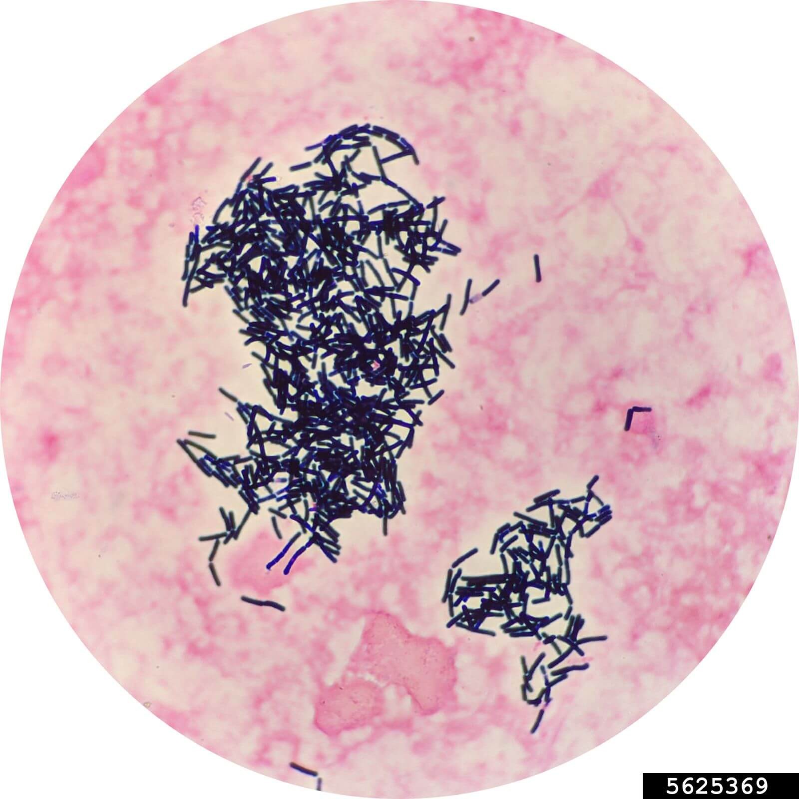 Hình ảnh hiển vi cho thấy vi khuẩn hình que Bacillus thurigiensis