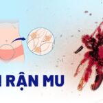 Rận mu ký sinh trên lông