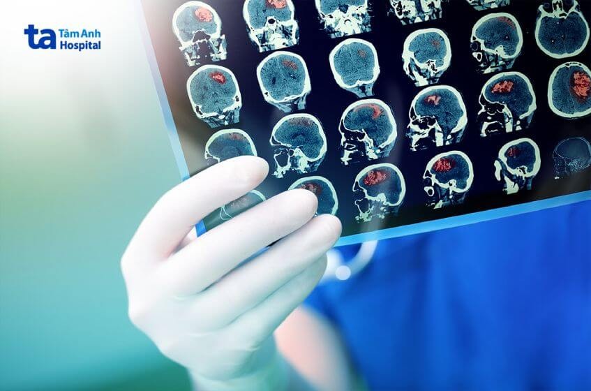 Hình ảnh minh họa máy chụp MRI