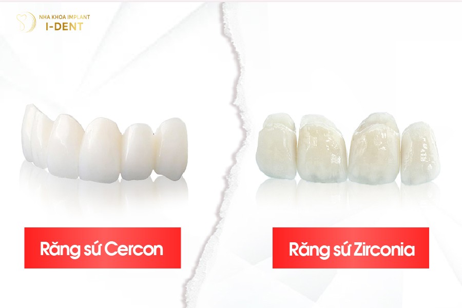 So sánh răng sứ Cercon và Zirconia để đưa ra lựa chọn tốt nhất