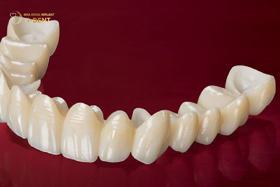 Răng sứ Zirconia cải thiện thẩm mỹ vùng răng nhai hiệu quả