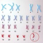Mô tả thể ba nhiễm sắc thể