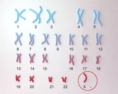Mô tả thể ba nhiễm sắc thể