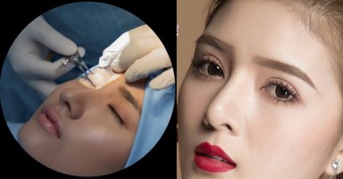 Quy trình cắt mắt 2 mí