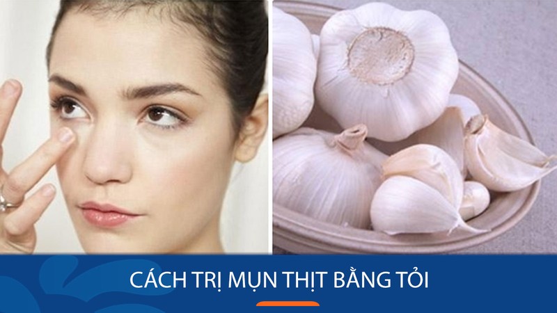 Xe Tải Mỹ Đình - Địa chỉ tin cậy cho mọi thông tin về xe tải và sức khỏe