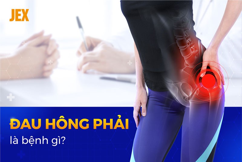 Đau hông phải