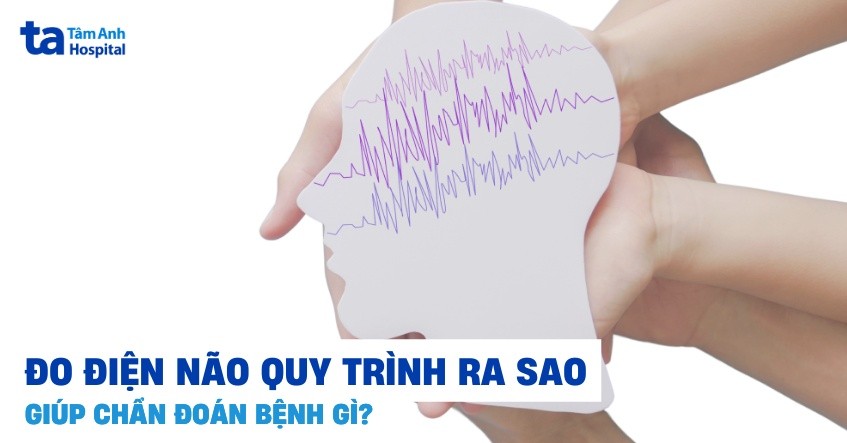 Điện não đồ thường quy để đánh giá hoạt động não khi tỉnh táo