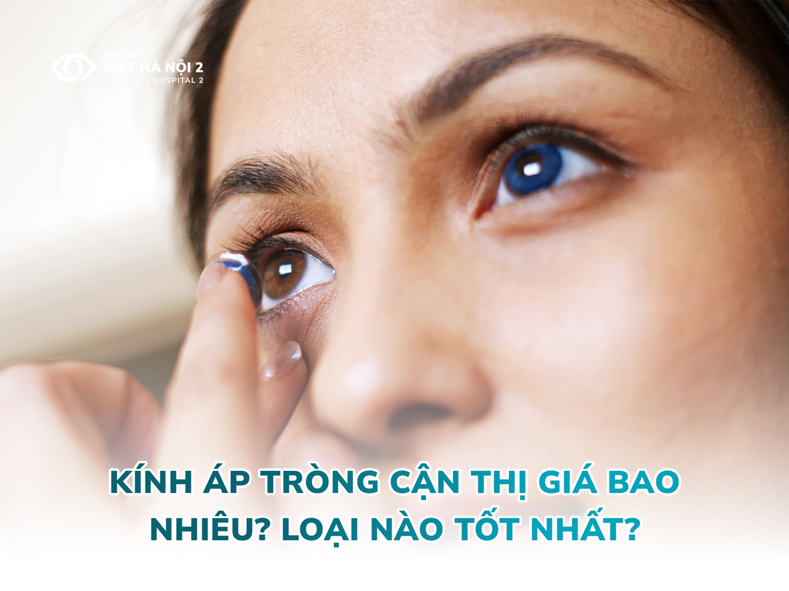 Các loại kính áp tròng cận thị phổ biến