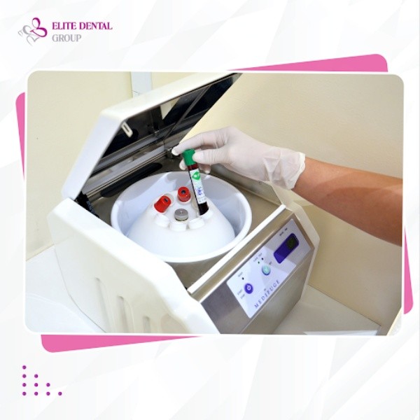 nhổ răng khôn có được bảo hiểm y tế không