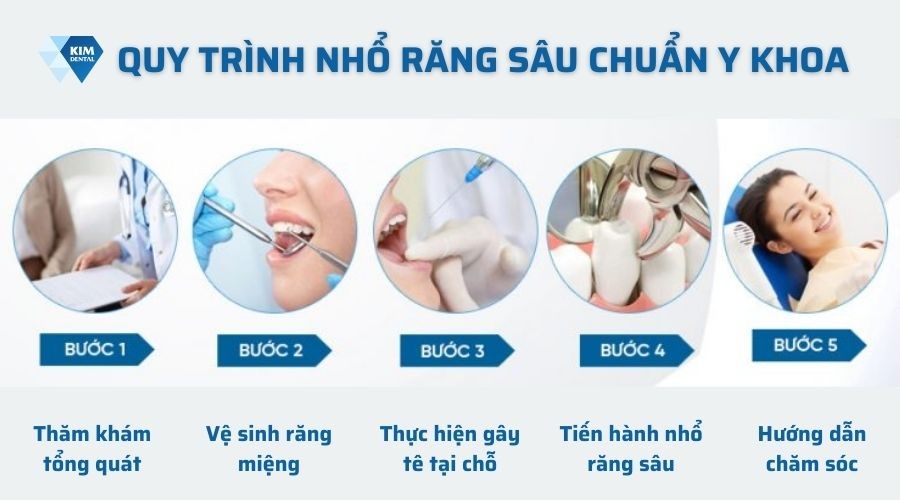 Quy trình nhổ răng