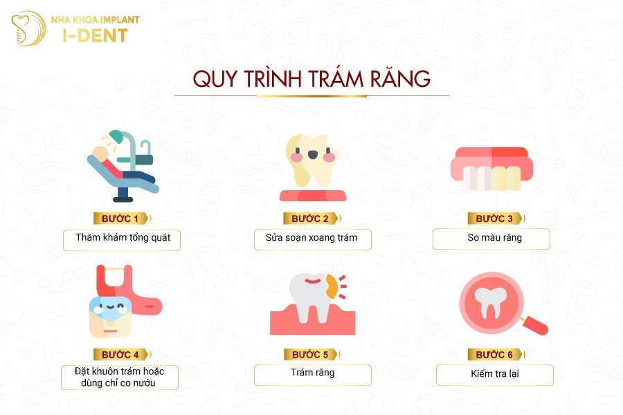 Quy trình trám răng thẩm mỹ tại nha khoa
