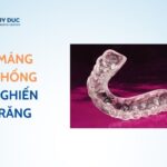 Miếng Chống Nghiến Răng Là Gì