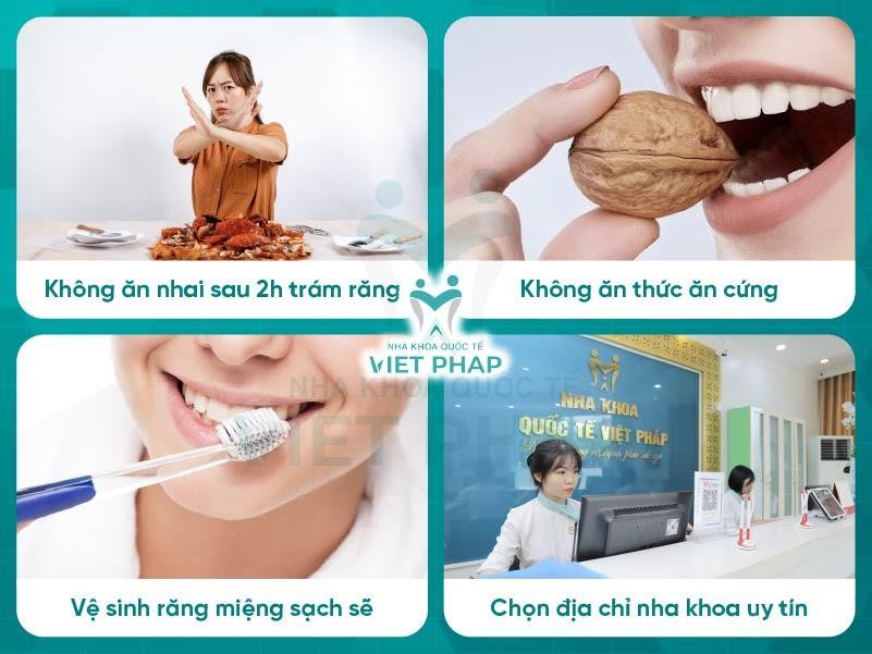 Những lưu ý sau khi trám răng